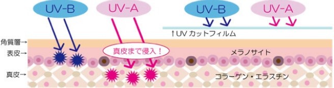 紫外線が肌に与える影響